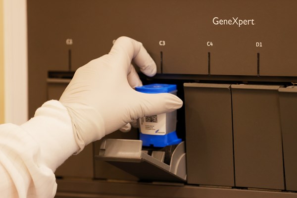 検査車両に搭載されたGeneXpertという多重伝送分子生物学用分析装置（Tom Pennington/Getty Images）