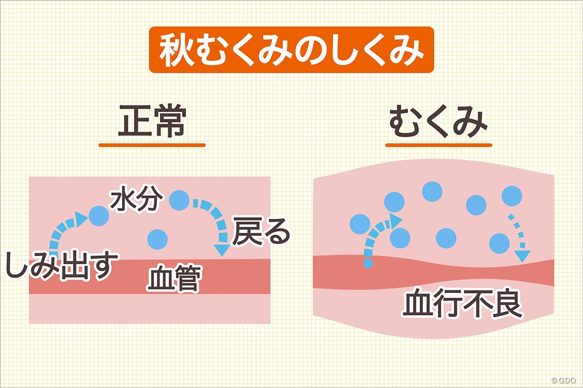 むくみの予防には...