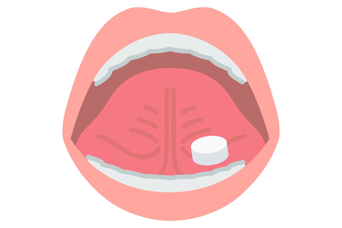 花粉症キャディ50人に聞いた！ 他ではあまり教えたくない“ここだけ”の対策法